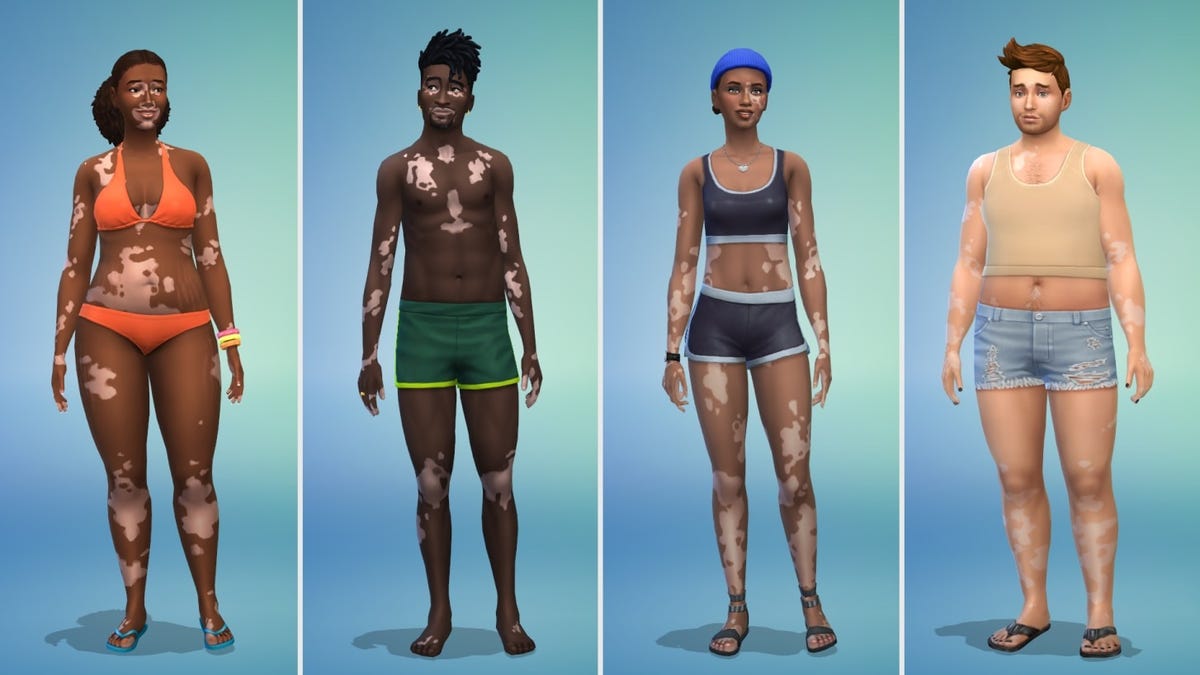 Sims 4 گزینه های پوست ویتیلیگو را در به روز رسانی رایگان اضافه می کند